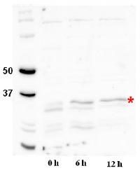 DGAT2A | Acyl-CoA: Diacylglycerol acyltransferase in the group Antibodies Plant/Algal  / DNA/RNA/Cell Cycle / Translation at Agrisera AB (Antibodies for research) (AS12 1874)